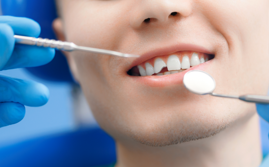 Man with broken tooth undergoing dental exam